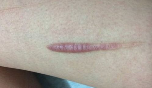 湘潭市美容哪家醫(yī)院好？探尋專家推薦，找到適合你的醫(yī)美機構(gòu)！