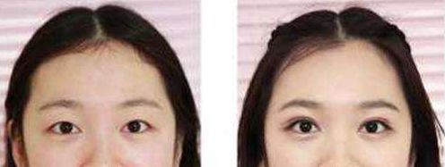 長沙整形科醫(yī)院排名及綜合評價：長沙哪家整形醫(yī)院口碑好？