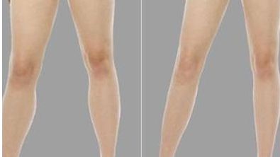 南京埋線醫(yī)院哪家好？權(quán)威專家推薦五家頂級醫(yī)院！