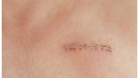 江蘇省中醫(yī)院整形科是否有專業(yè)資質(zhì)？醫(yī)生擅長(zhǎng)哪些項(xiàng)目？簡(jiǎn)介了解一下！