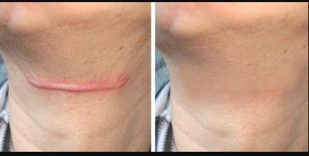 南京取出奧美定哪家好？南京市區(qū)有哪些口碑較好的奧美取出門店？