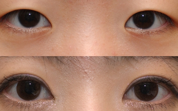 昆明韓辰陳寧醫(yī)生實(shí)力解析，技術(shù)評(píng)估及特色服務(wù)一覽!