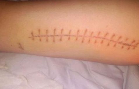 常熟哪家看痘痘醫(yī)院好？專家推薦常熟治療痘痘靠譜的醫(yī)院有哪些？