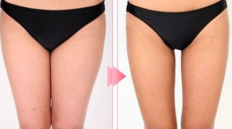 廊坊去斑的醫(yī)院哪家好？推薦您去哪家專業(yè)的醫(yī)院進(jìn)行去斑治療