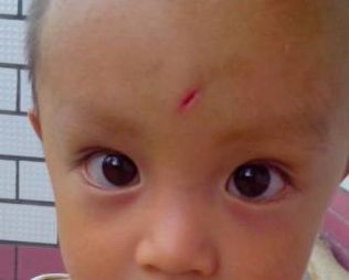 青島童顏線雕提升哪家好？選擇最佳青島童顏線雕醫(yī)院的3個(gè)關(guān)鍵因素