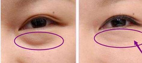 東莞豐胸醫(yī)生名單推薦！權(quán)威醫(yī)師梁如光、鄭志敏等值得信賴