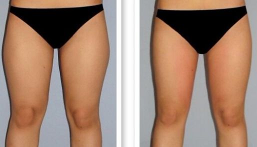 濟(jì)南祛痘哪家醫(yī)院技術(shù)好？選擇哪家醫(yī)院更靠譜？