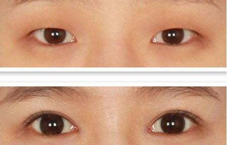 北京整容科好的醫(yī)院有哪些？中關(guān)村整形醫(yī)院綜合實力領(lǐng)先！