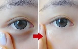 西安微整醫(yī)院排行榜2023：哪家最好？