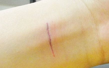 上海哪家隆鼻醫(yī)院好且正規(guī)？?jī)?yōu)質(zhì)咨詢幫助你挑選合適的醫(yī)院