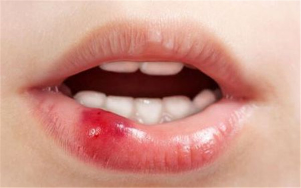 2023貴州祛頸紋嗨體權威醫(yī)生排名榜前十(魏在榮、張凱、張連洪這份專家名單推薦給你)