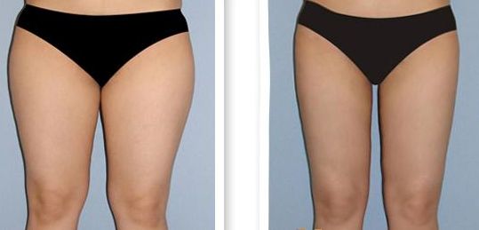 泉州醫(yī)院哪家做手術(shù)好？選泉州醫(yī)院手術(shù)排名榜單