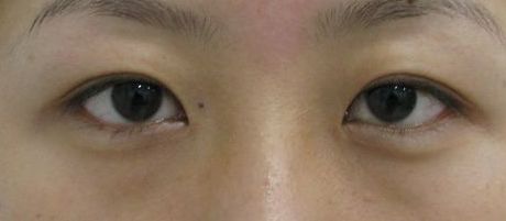 南寧哪家美容整形醫(yī)院口碑好又實(shí)惠？