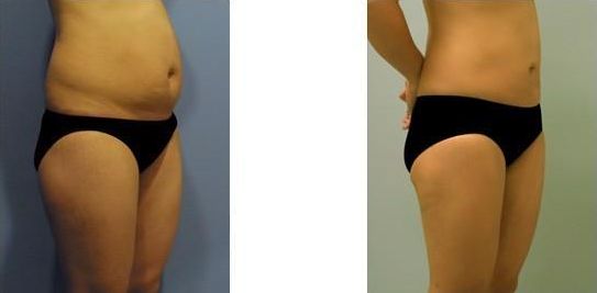 濟(jì)南哪家醫(yī)院做雙眼皮效果好？