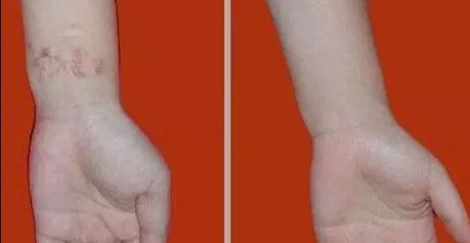 杭州哪家醫(yī)院看喉嚨好？排名最好的專業(yè)醫(yī)院推薦