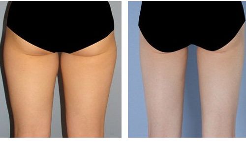 重慶康美整形美容醫(yī)院門診有用戶好評嗎？醫(yī)生資料和價格表全面解讀