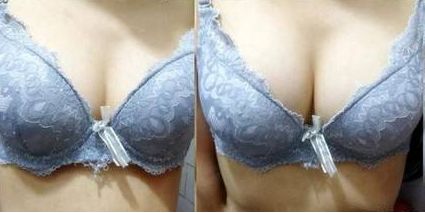 上饒雙眼皮手術(shù)哪家醫(yī)院好？專業(yè)排名推薦！