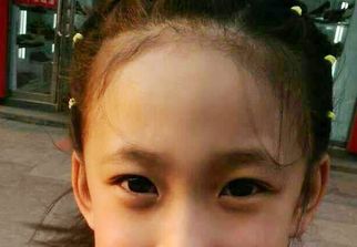 蘇州激光祛疤哪家醫(yī)院好？選擇激光祛疤專家，恢復美肌無憂！