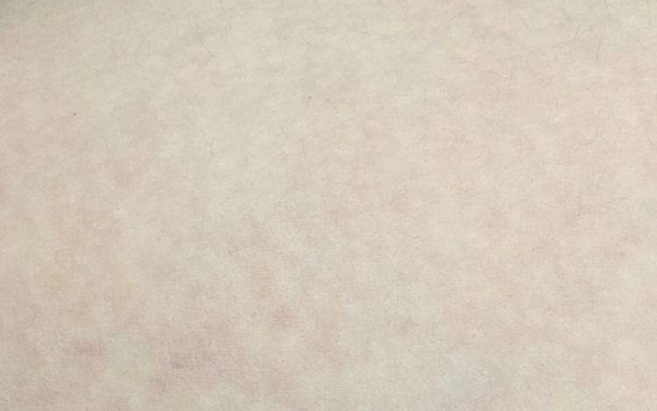 大連哪位醫(yī)生在顴骨整形方面?zhèn)涫懿毮?？關注的5位專家包括關世超、張東、蔡軍。