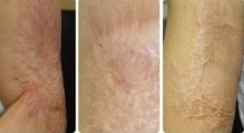 【2023廈門】專業(yè)廈門埋線減肥醫(yī)院哪家口碑好？