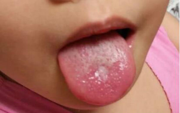 2023南昌祛除口周紋手術(shù)強(qiáng)榜前10的醫(yī)生(李焱麗、李丹、徐愛(ài)兵口碑技術(shù)并存)