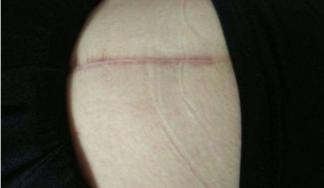 杭州市哪家醫(yī)院的玻尿酸注射技術(shù)更好？附醫(yī)生資料及整形科點(diǎn)評(píng)