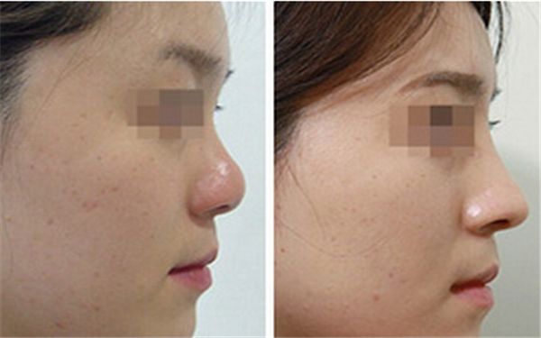 珠海市醫(yī)療美容醫(yī)院哪家好？解析當今最受歡迎的珠海醫(yī)療美容機構(gòu)