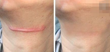 貴州哪個醫(yī)院做眼袋手術好