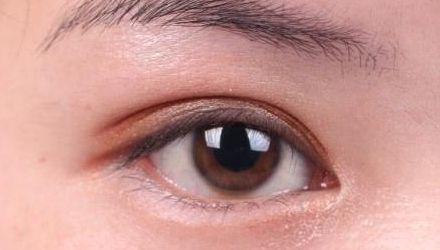 蘇州雙眼皮修復醫(yī)院排名及口碑，哪家醫(yī)院修復效果最好？