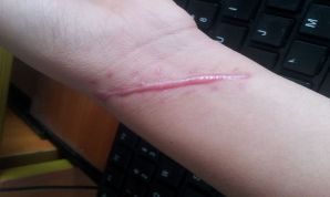 上海鼻子整形哪家醫(yī)生好？整形手術(shù)中哪位醫(yī)生在上海受歡迎？