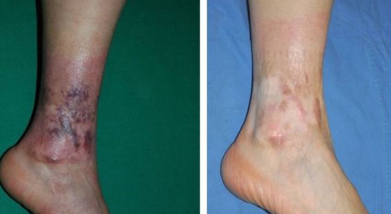 上海手術(shù)點痣醫(yī)院哪家好？揭秘上海最受歡迎的點痣醫(yī)院