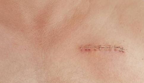 南昌市整形醫(yī)院哪家好？完全解析南昌市整形醫(yī)院的專業(yè)技術(shù)和服務(wù)