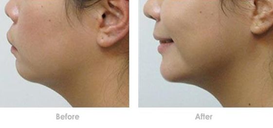 成都哪家醫(yī)美醫(yī)院做皮秒好？了解成都皮秒治療哪家醫(yī)院口碑好