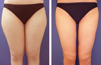 廣州看痘印哪家醫(yī)院好？細數(shù)廣州治療痘印最佳醫(yī)院！