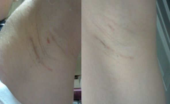 恩施地區(qū)有哪些信譽(yù)好的美容整形醫(yī)院？