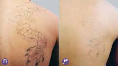 無錫哪家醫(yī)院眼科專業(yè)好？