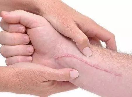 昆明雙眼皮修復，哪家醫(yī)院專業(yè)且可靠？