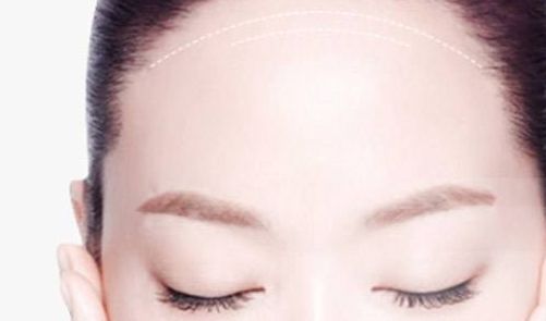 深圳哪家醫(yī)院的皮秒激光手術效果好？