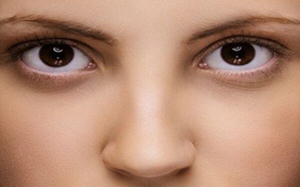 李運峰醫(yī)生下頜角手術(shù)的效果如何？丨下頜角案例：“瓜子臉”與“蛇精臉”形態(tài)有何不同