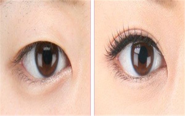 中國(guó)哪家醫(yī)院皮膚修復(fù)好？專家告訴你最靠譜的皮膚修復(fù)醫(yī)院有哪些