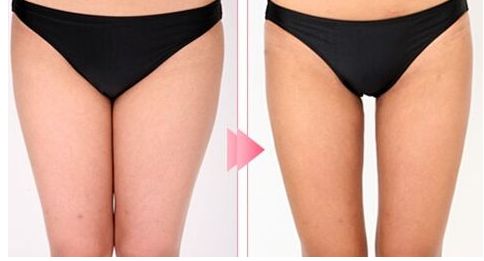 昆明哪家醫(yī)院做拉皮手術(shù)好？體驗分享+專家推薦，盡在本文！