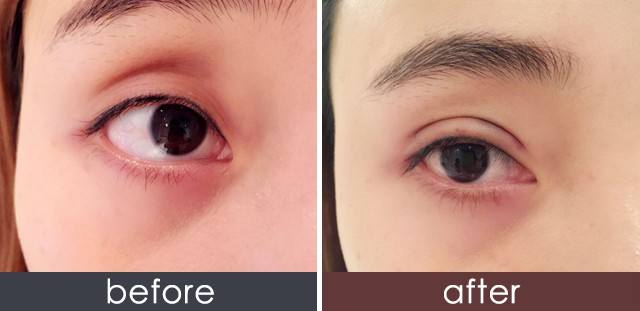 2023貴陽手術改善臉部松弛醫(yī)生口碑榜TOP10(王秀紅、黃羽、譚旭口碑怎么樣？技術靠譜嗎)