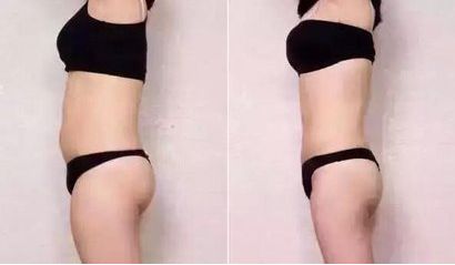 太原哪家醫(yī)院祛痘效果好？專家推薦的太原祛痘醫(yī)院排行榜