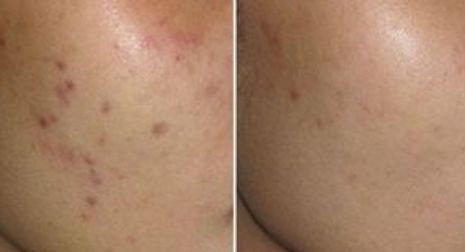 成都星范醫(yī)療美容整形醫(yī)院的醫(yī)生口碑如何？