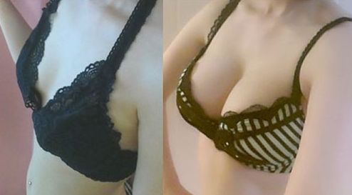 廣州哪家醫(yī)院做微針好？解讀廣州市內(nèi)頂尖微針治療機(jī)構(gòu)