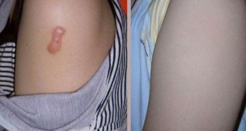 長(zhǎng)沙整形哪家美容醫(yī)院好？專(zhuān)家揭秘長(zhǎng)沙市頂級(jí)整形醫(yī)院排行榜！