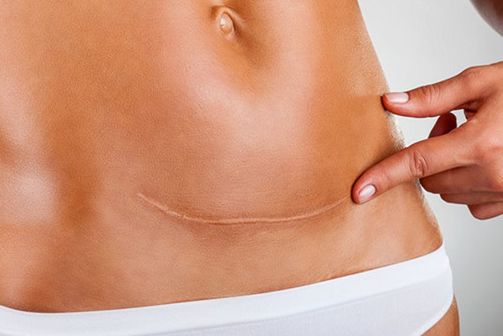 2023西安雙眼皮最佳醫(yī)院排行榜：哪家醫(yī)院的雙眼皮效果好？