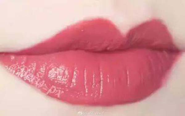 2023深圳點(diǎn)陣激光祛痘印專家TOP10(楊淑純、李曉平、李海亮更靠譜！)