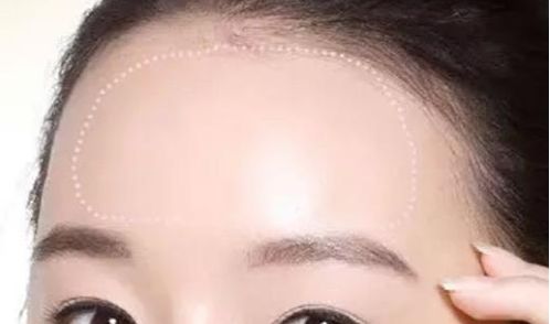 常州治療脫發(fā)哪家醫(yī)院靠譜？