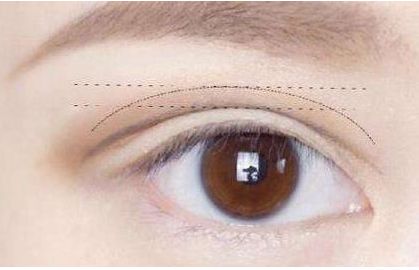 佛山哪家整容醫(yī)院的隆鼻效果出色？